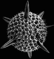 Microscope image is a single round radiolarian, with external projections.