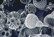 Microscope image of assorted radiolaria.